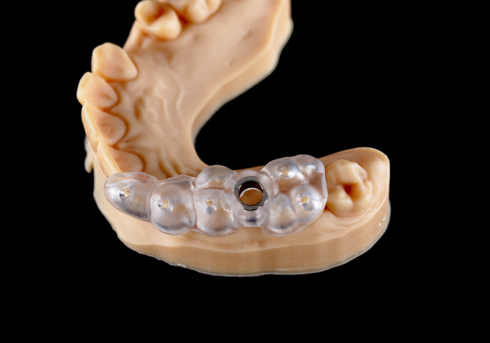 ガイデッドサージェリーに対応